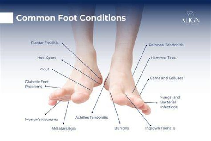 Feet problems Feet problems