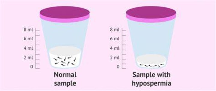How to Know if Your Semen Volume is Normal