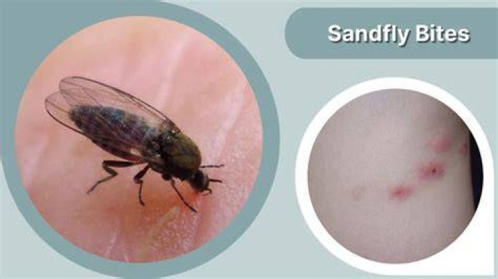 Sandfly bites are a less welcome side to summer. Photo / Wikimedia Commons