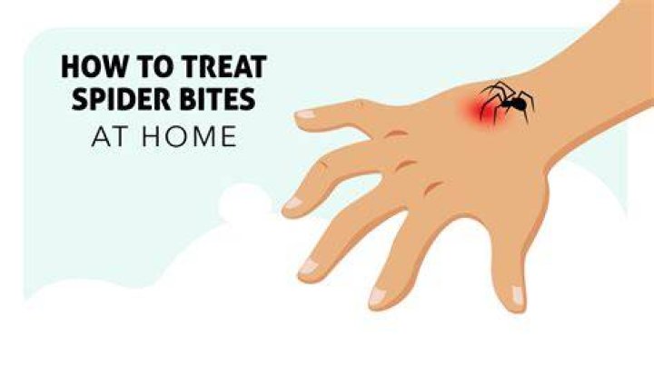 What To Put On Spider Bite To Draw Out Poison