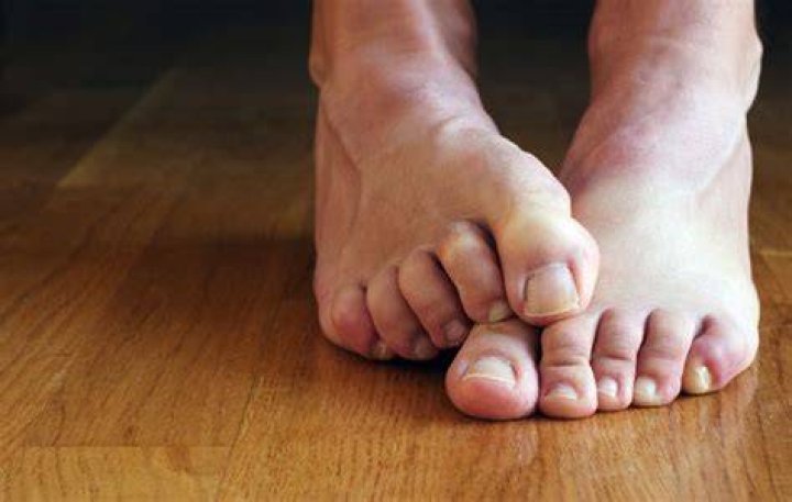 Your Grossest Feet Problems, Solved